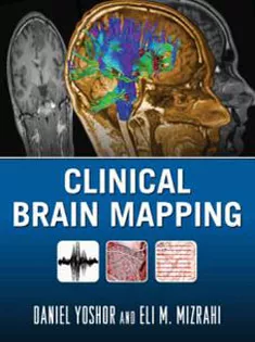 Clinical Brain Mapping