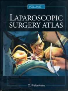 Laparoscopic Surgery Atlas