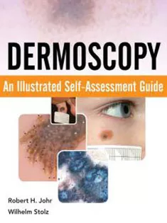 Dermoscopy: An Illustrated Guide