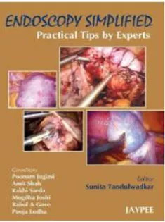 Gynecological Endoscopy Simplified: Practical Tips by Experts