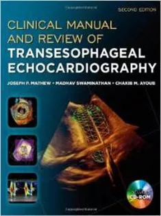 Clinical Manual and Review of Transesophageal Echocardiography