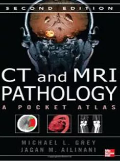 CT & MRI Pathology: A Pocket Atlas