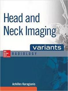 Head and Neck Imaging Variants