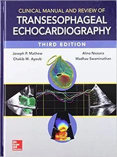 Clinical Manual and Review of Transesophageal Echocardiography