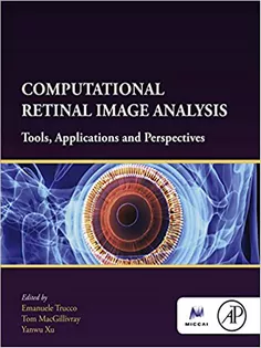 Computational Retinal Image Analysis