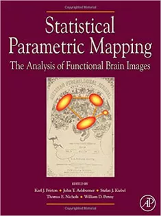 Statistical Parametric Mapping