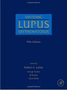Systemic Lupus Erythematosus