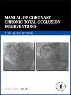 Manual of Coronary Chronic Total Occlusion Interventions