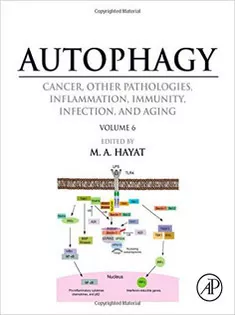 Autophagy: Cancer, Other Pathologies, Inflammation, Immunity, Infection, and Aging: Vol 6- Regulation of Autophagy An