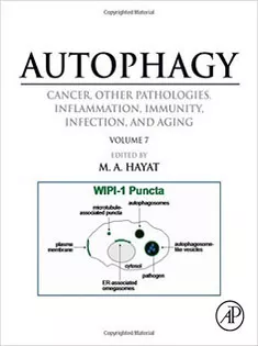 Autophagy: Cancer, Other Pathologies, Inflammation, Immunity, Infection, and Aging: Vol 7- Role of Autophagy in Thera