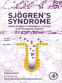 Sjogren's Syndrome