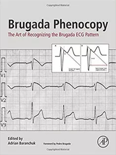 Brugada Phenocopy