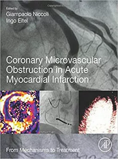 Coronary Microvascular Obstruction in Acute Myocardial Infarction From Mechanisms to Treatment
