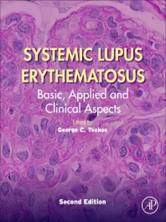 Systemic Lupus Erythematosus: Basic, Applied and Clinical Aspects