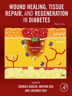 Wound Healing, Tissue Repair, and Regeneration in Diabetes