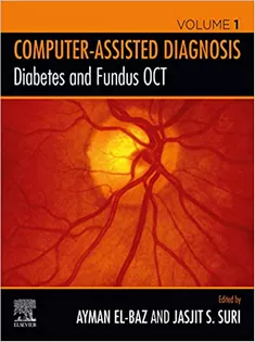 Computer-Assisted Diagnosis Diabetes and Fundus OCT