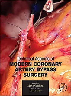 Technical Aspects of Modern Coronary Artery Bypass Surgery