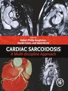 Cardiac Sarcoidosis: A Multi-discipline Approach