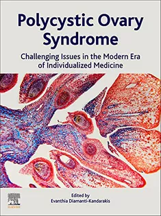 9780128230459 Polycystic Ovary Syndrome: Challenging Issues in the Modern Era of Individualized Medicine