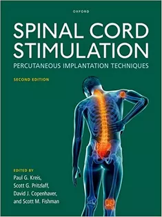 Spinal Cord Stimulation
