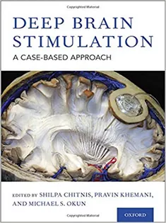 Deep Brain Stimulation: A Case-based Approach