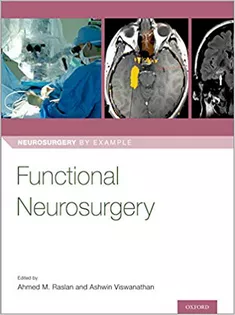 Functional Neurosurgery