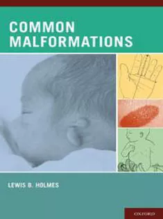 Common Malformations