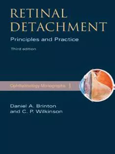 Retinal Detachment: Priniciples and Practice
