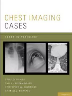Cases Chest Imaging