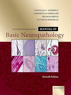 Escourolle and Poirier's Manual of Basic Neuropathology