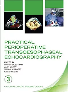 Practical Perioperative Transoesophageal Echocardiography