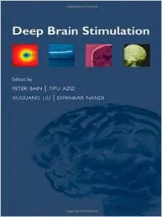 Deep Brain Stimulation