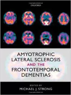 Amyotrophic Lateral Sclerosis and the Frontotemporal Dementias
