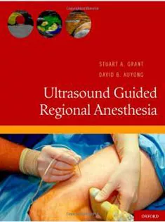Ultrasound Guided Regional Anesthesia 2012