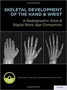 Skeletal Development of the Hand and Wrist