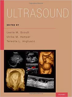 Ultrasound- Scoutt