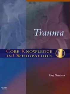 Core Knowledge in Orthopaedics: Trauma