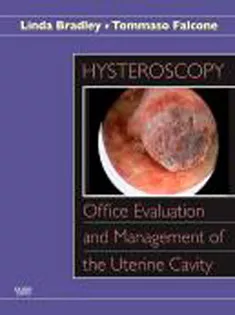 Hysteroscopy: Office Evaluation and Management of the Uterine Cavity