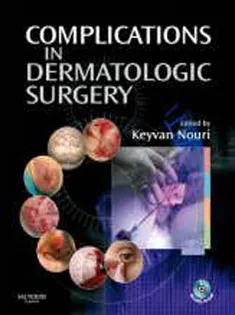 Complications In Dermatologic Surgery