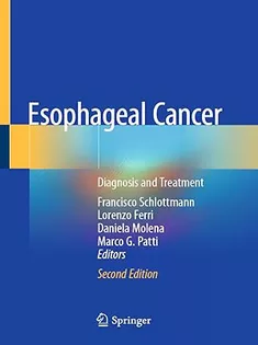 ‎Esophageal Cancer Diagnosis and Treatment