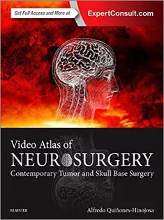 Video Atlas of Neurosurgery: Contemporary Tumor and Skull Base Surgery