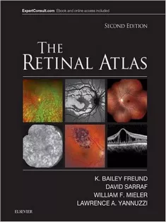 9780323287920 The Retinal Atlas1