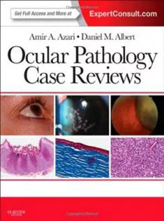 Ocular Pathology Case Reviews: Expert Consult