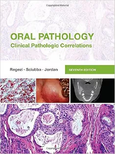 Oral Pathology: Clinical Pathologic Correlations