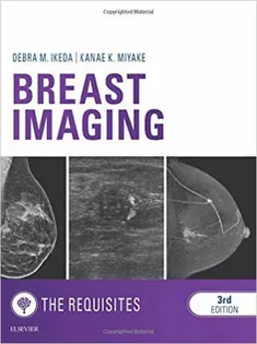 The Requisites :Breast Imaging