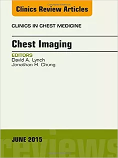 9780323388801 Chest Imaging, An Issue of Clinics in Chest Medicine
