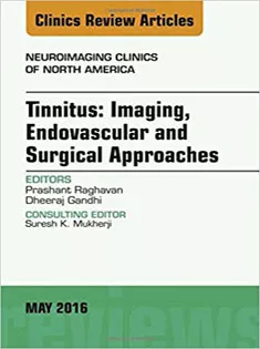 Tinnitus: Imaging, Endovascular and Surgical Approaches, An Issue of Neuroimaging Clinics