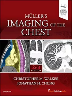 Muller's Imaging of the Chest Expert Radiology Series
