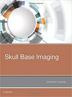 Skull Base Imaging