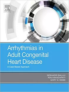 Arrhythmias in Adult Congenital Heart Disease